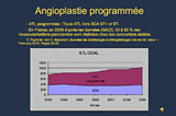Gestion des antithrombotiques dans l'angioplastie programmée en 2010