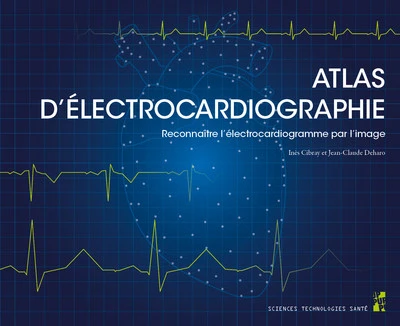 >Atlas d'lectrocardiographie