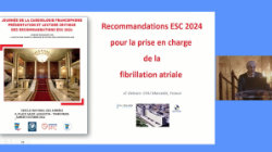 Recommandations Fibrillation atriale