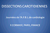 Dissections carotidiennes