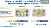 Expérience avec la valve 

Edwards Sapien / Marie-Claude Morice 