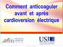 Comment anticoaguler avant et aprs cardioversion lectrique? Simon Abou Jaoud