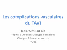 Complications vasculaires des procdures interventionnelles 